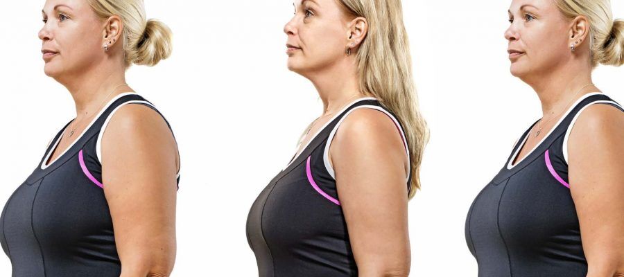 HodgeonRepeat blog - Stop Yo-yo dieting - picture of woman at different weights