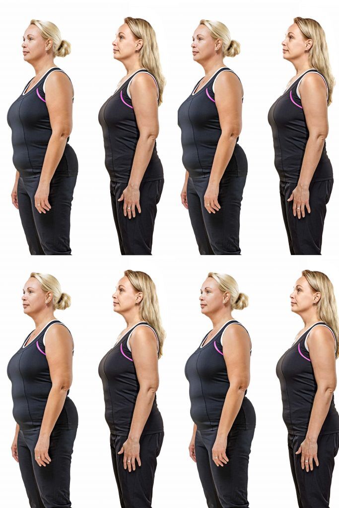 HodgeonRepeat blog - repeating image of woman before and after weight loss - yo-yo dieting